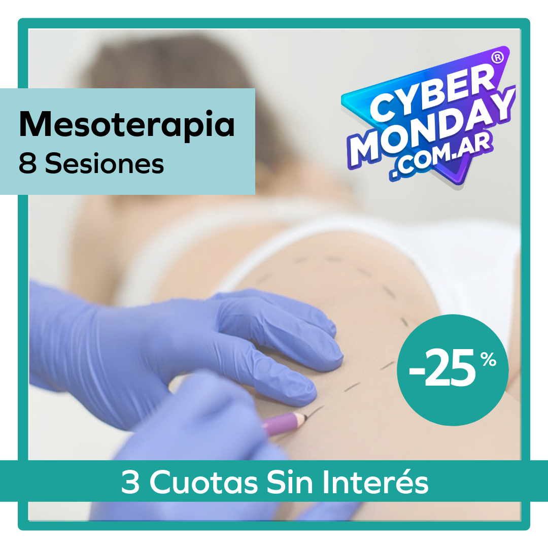 Mesoterapia